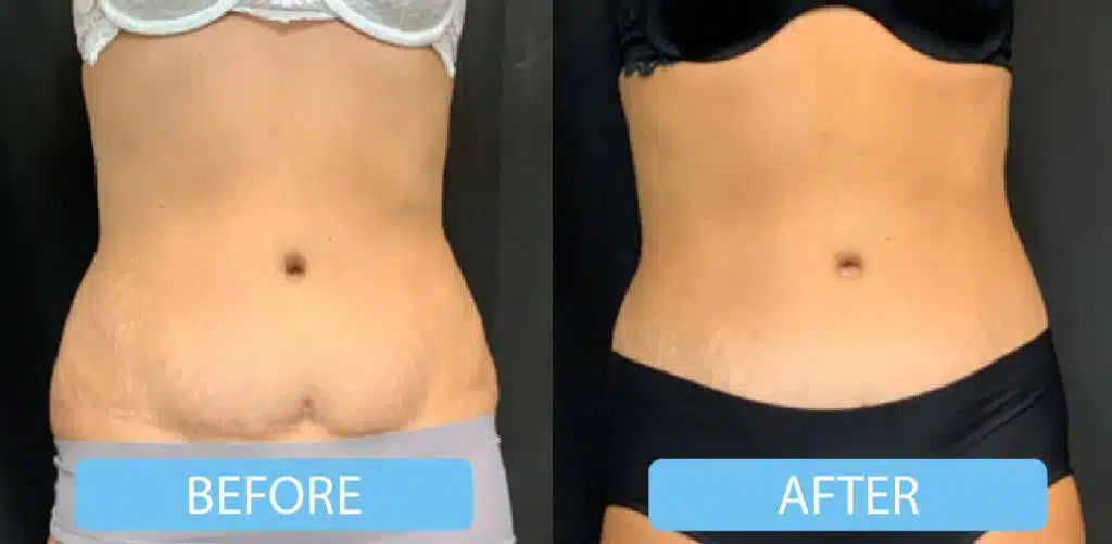 Pain management weight loss ￼