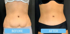 Pain management weight loss ￼