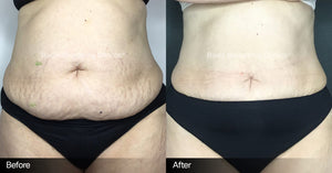 Pain management weight loss ￼