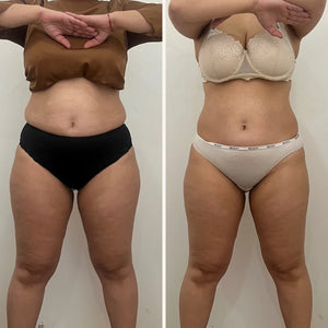 Pain management weight loss ￼