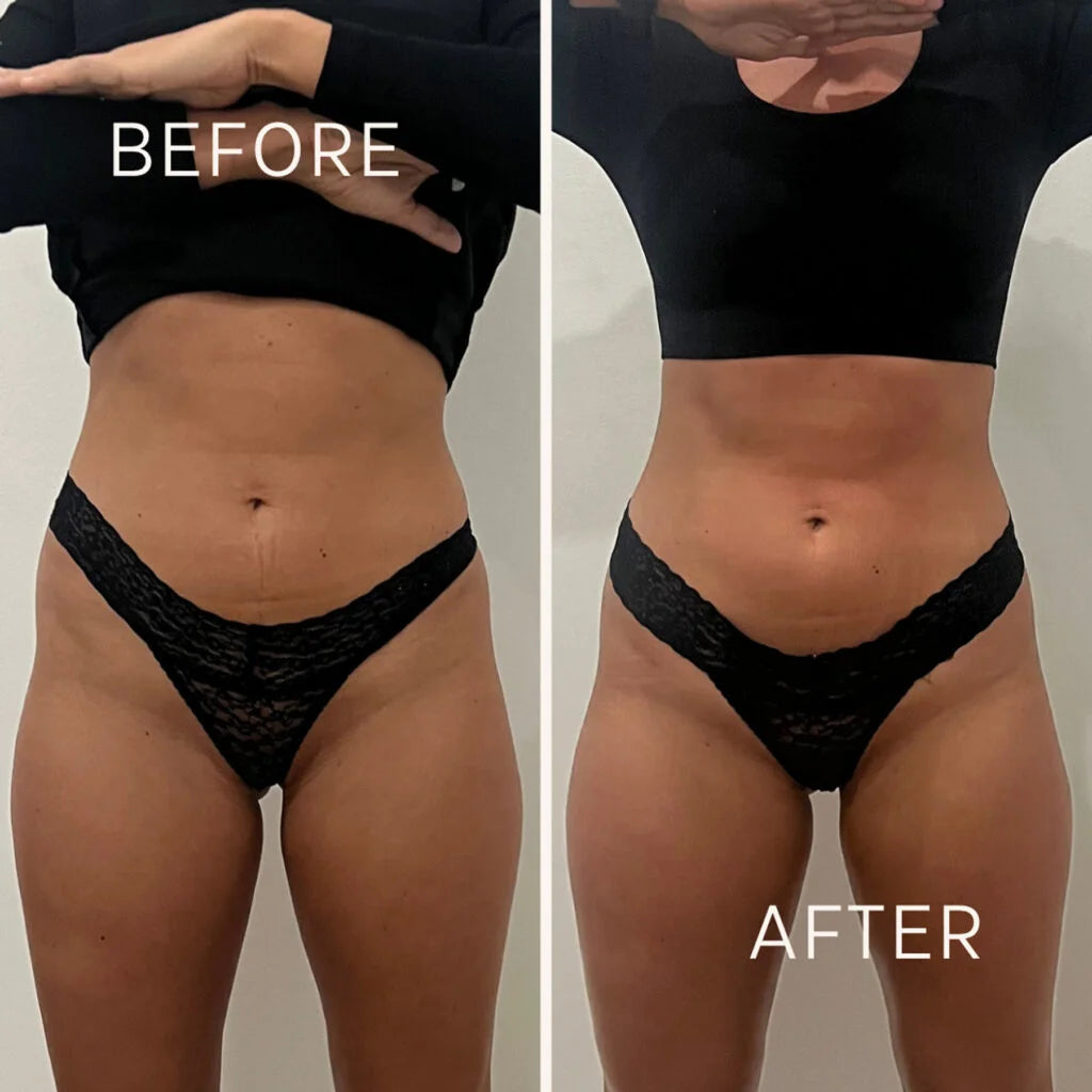 Pain management weight loss ￼