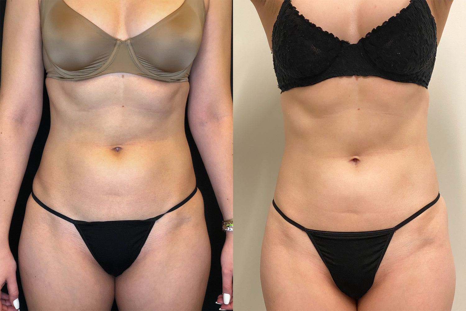 Pain management weight loss ￼