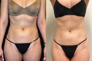 Pain management weight loss ￼