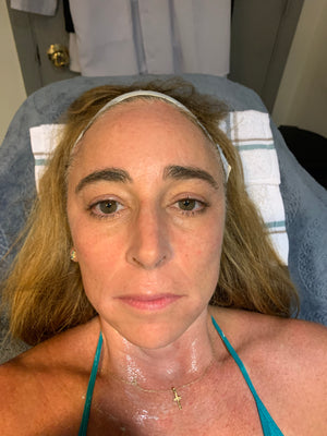 Shannon FL anti-age full treatment (price per session)