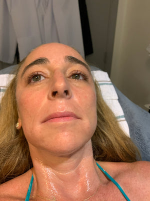Shannon FL anti-age full treatment (price per session)