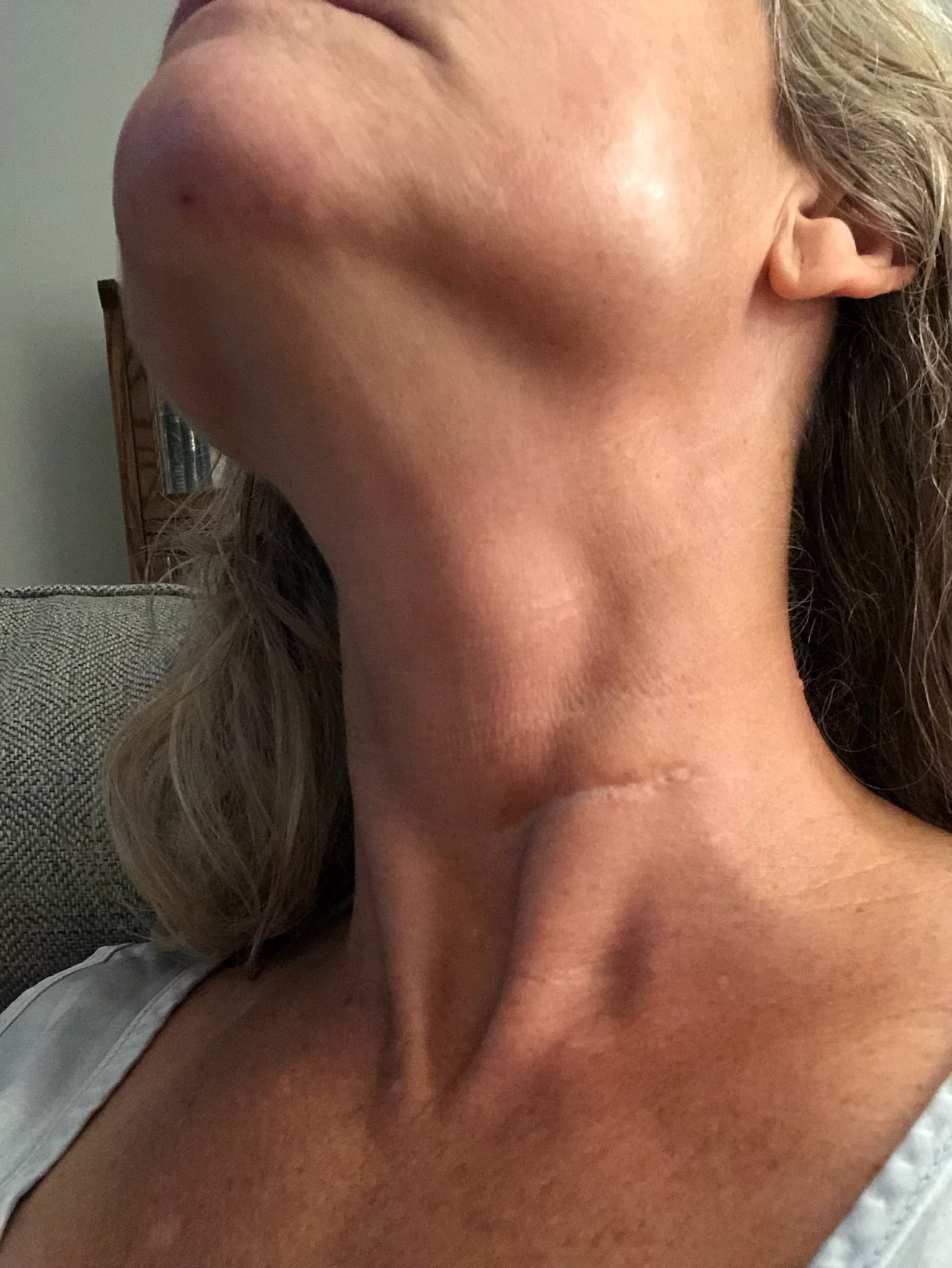 Jenny p. 59 reversing treatment