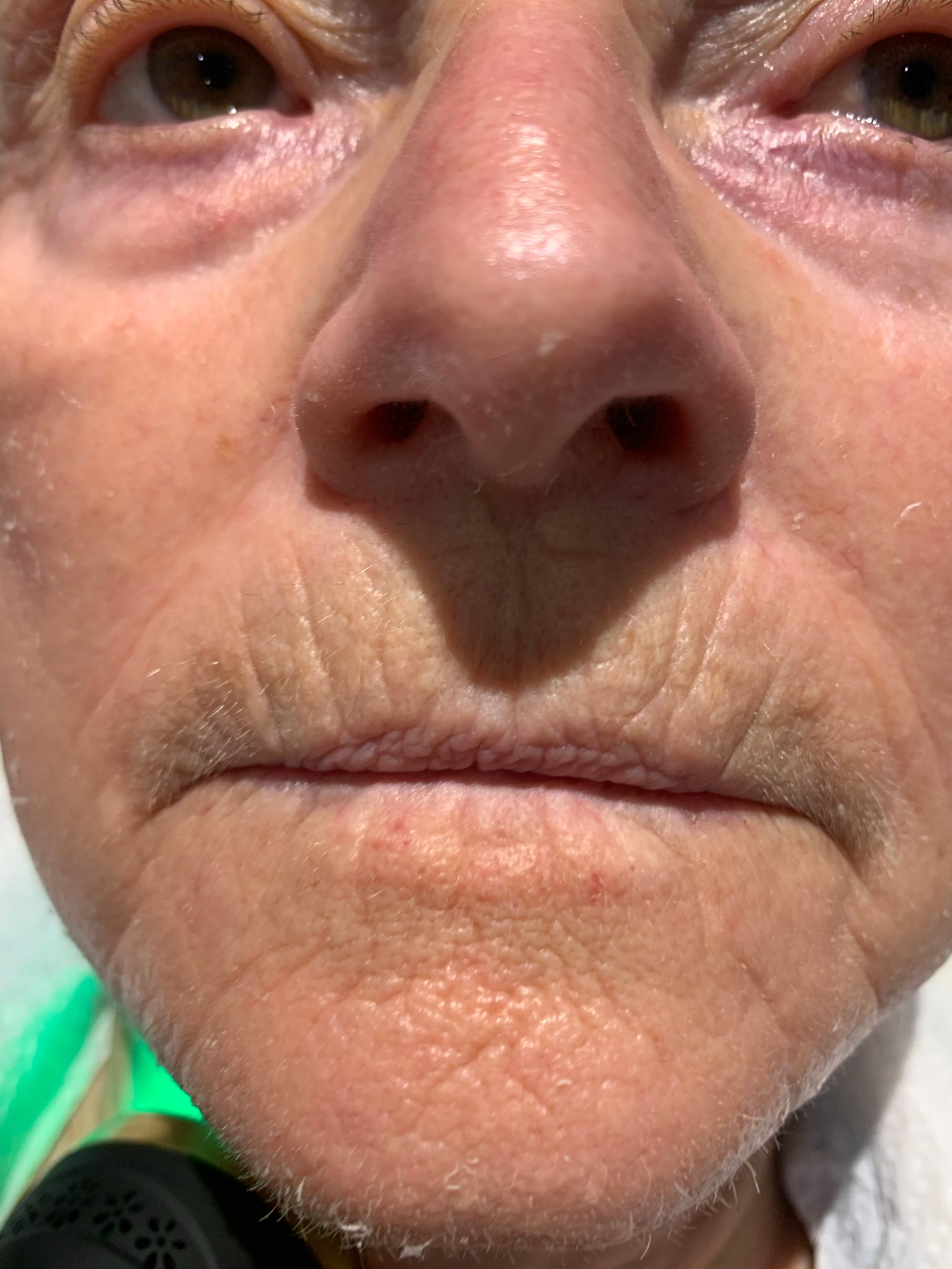 Anne 70+ amazing results