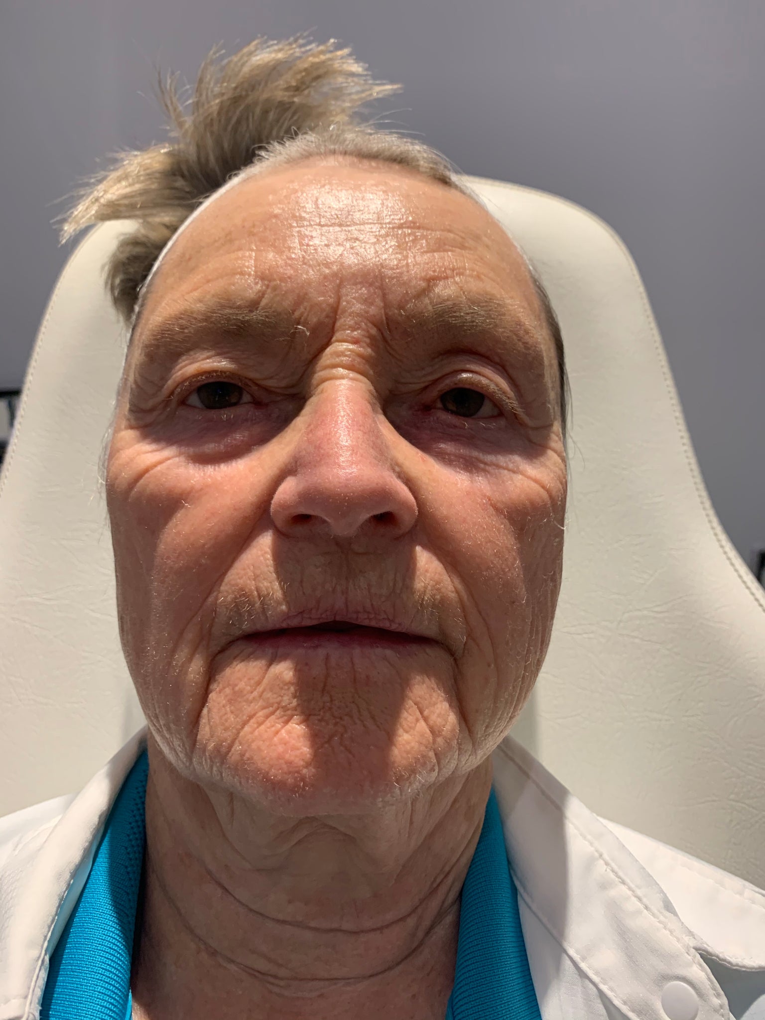 Anne 70+ amazing results