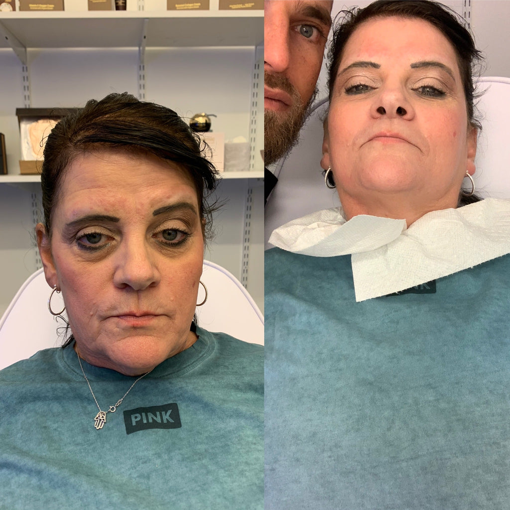 Anita r. Age 58